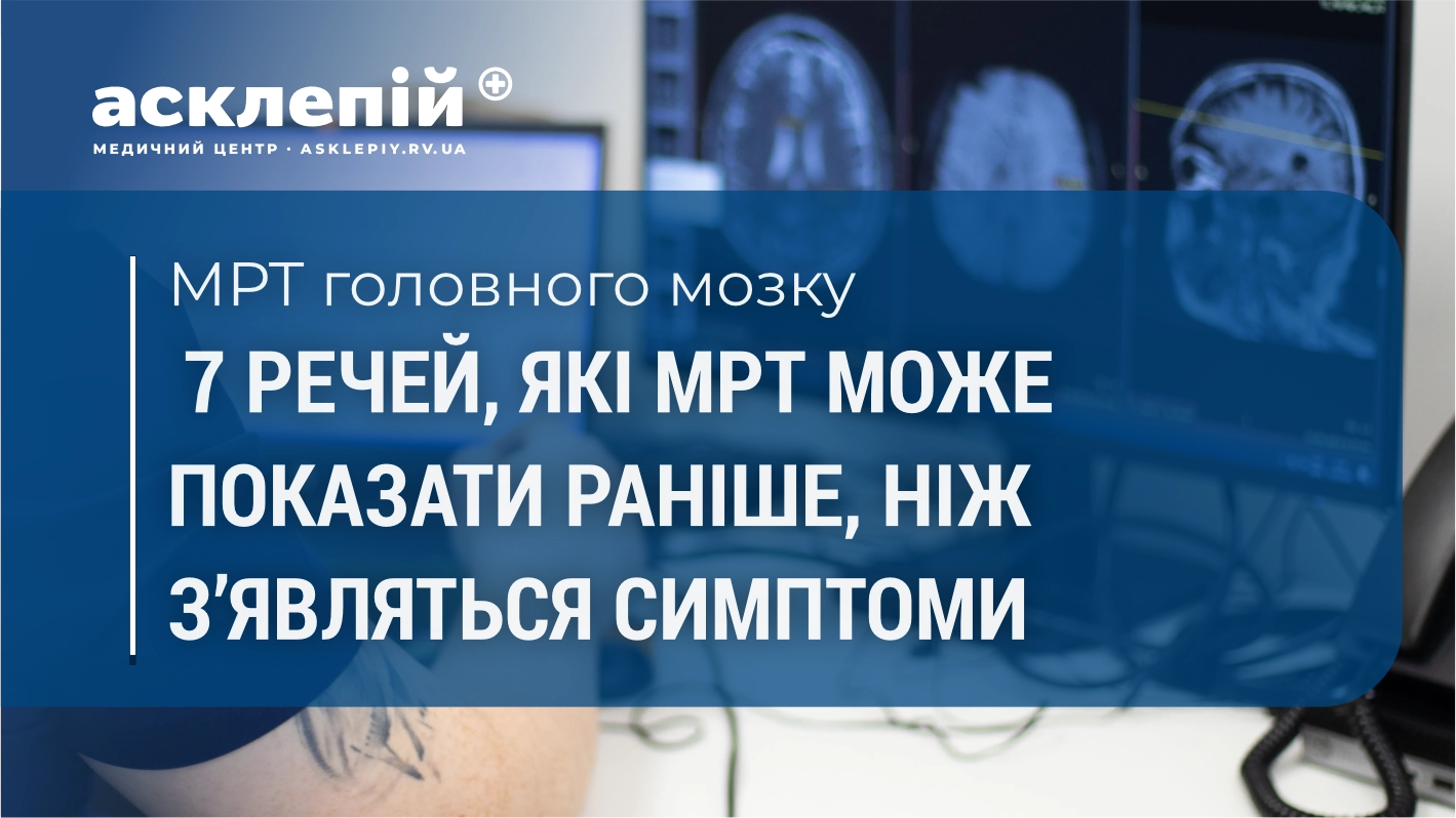 Що може показати МРТ головного мозку?