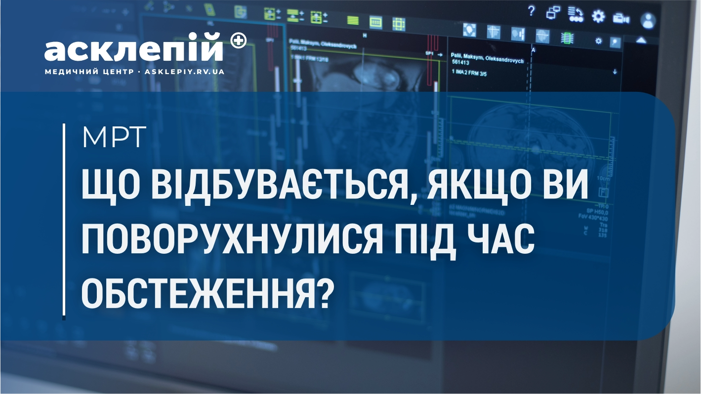 Чому на МРТ не можна рухатися?